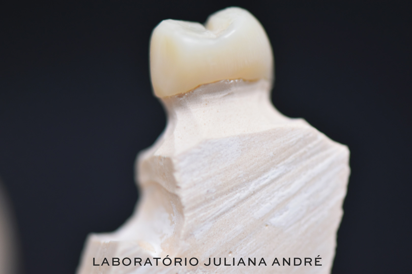 Prova de dentes impressa