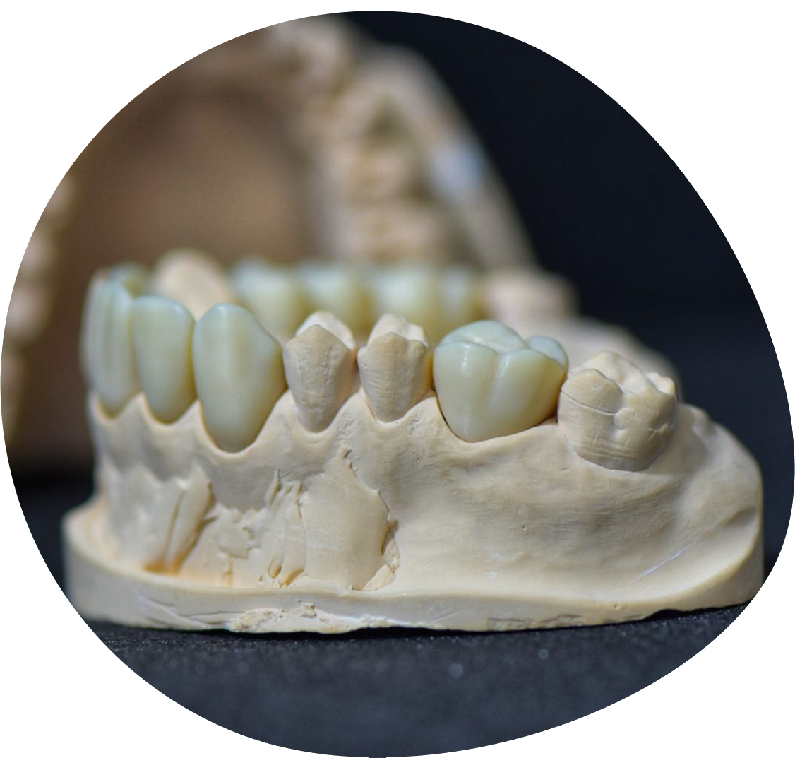 https://laboratoriojulianaandre.pt/wp-content/uploads/2022/05/ortodontia-fixa-mask.png
